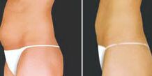 leo-16-51