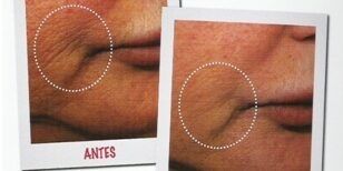 ATLEAN3