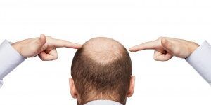 pelo-300×200