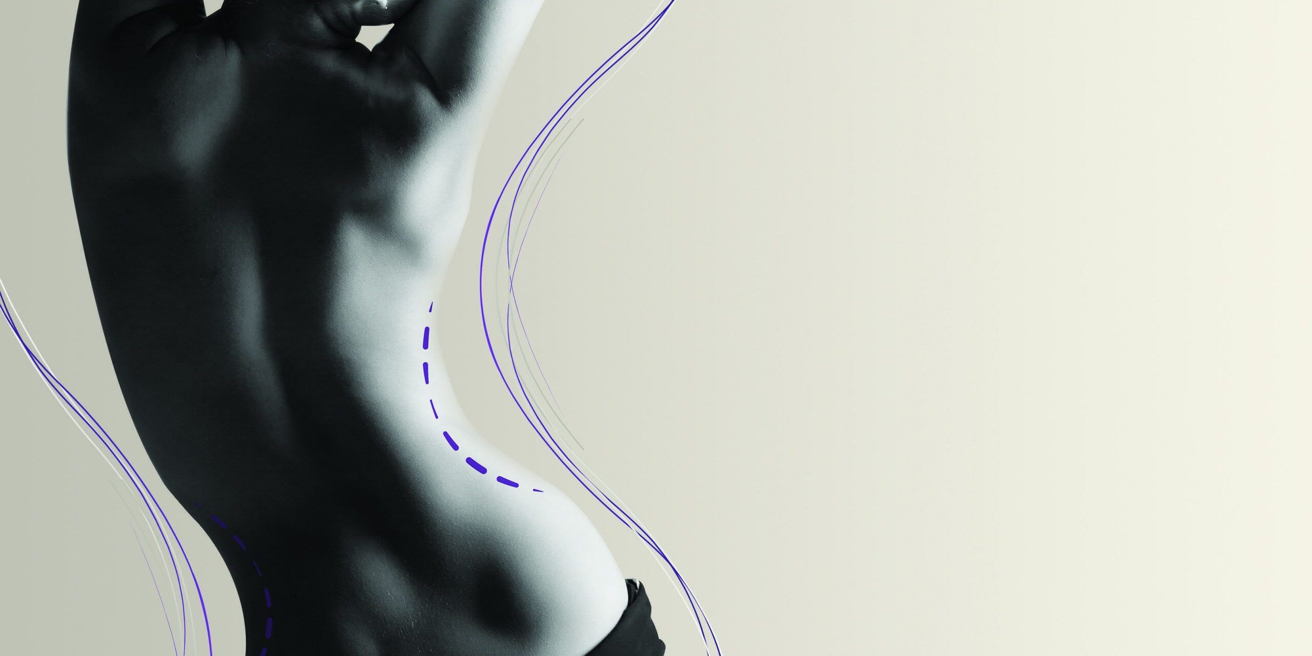 Tratamiento Accent Prime Imagen artística en blanco y negro de un torso femenino, tratamiento corporal Accent Prime