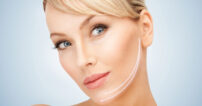 Retensado-ovalo-facial