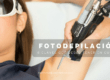 Fotodepilacion Laser