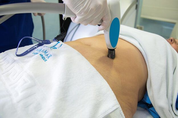 Cómo eliminar las estrías