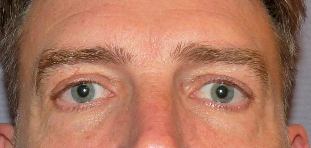 ANTES-Y-DESPUES-(18-antes)