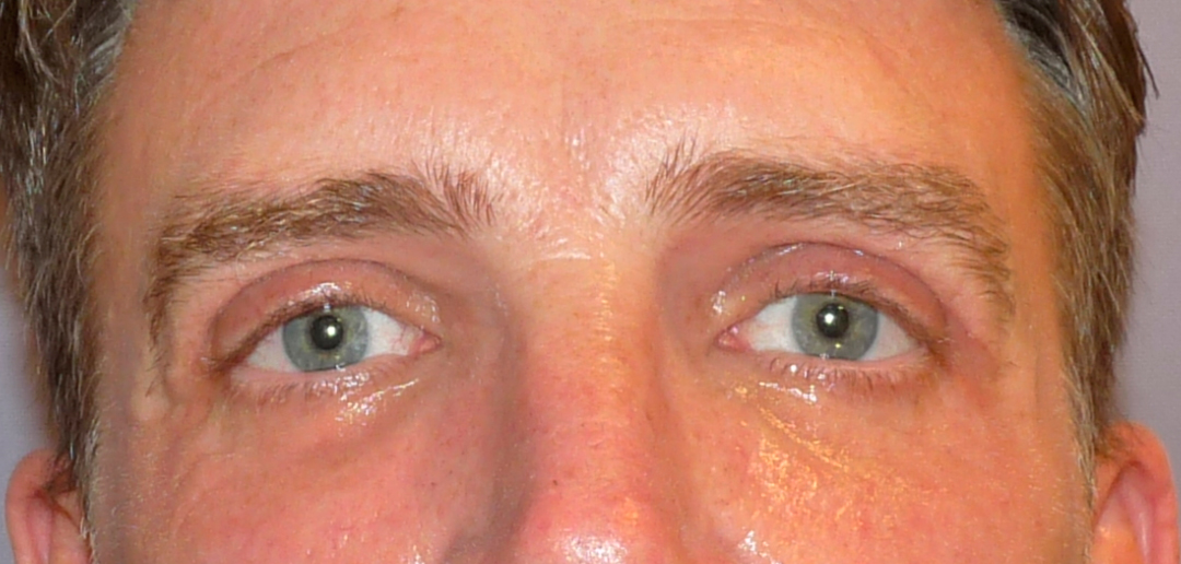 ANTES-Y-DESPUES-(18-despues)