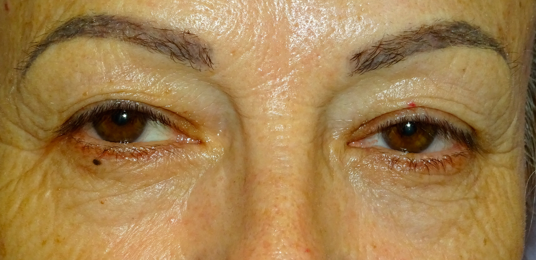 ANTES-Y-DESPUES-(26-antes)