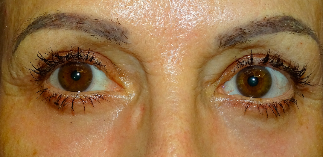 ANTES-Y-DESPUES-(26-despues)