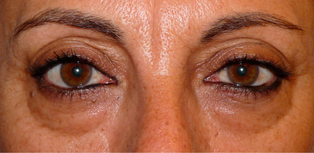 ANTES-Y-DESPUES-(27-antes)