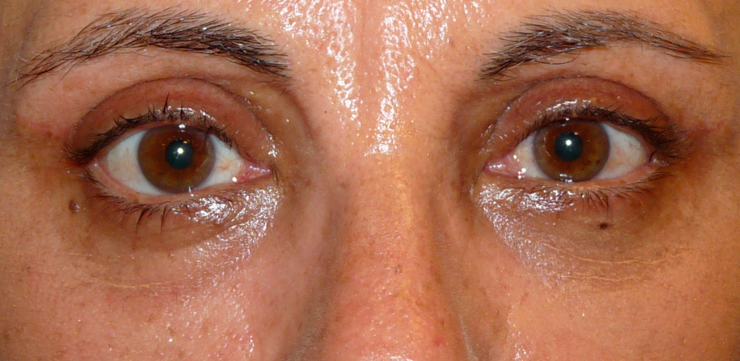 ANTES-Y-DESPUES-(27-detras)