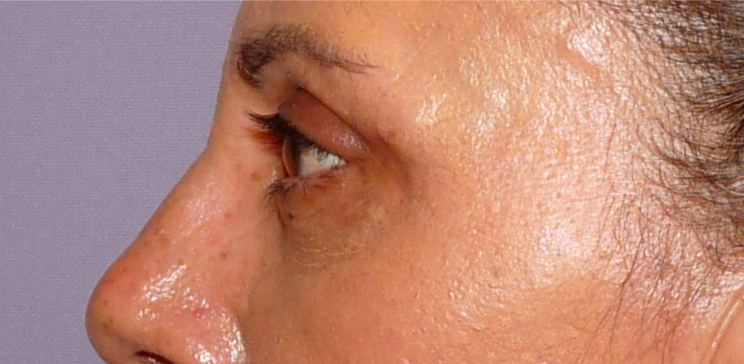 ANTES-Y-DESPUES-(28-despues)