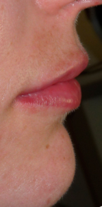 1034418-2-300×300-DESPUES