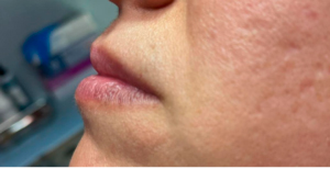 ANTES-Y-DESPUES-30-300×300-ANTES